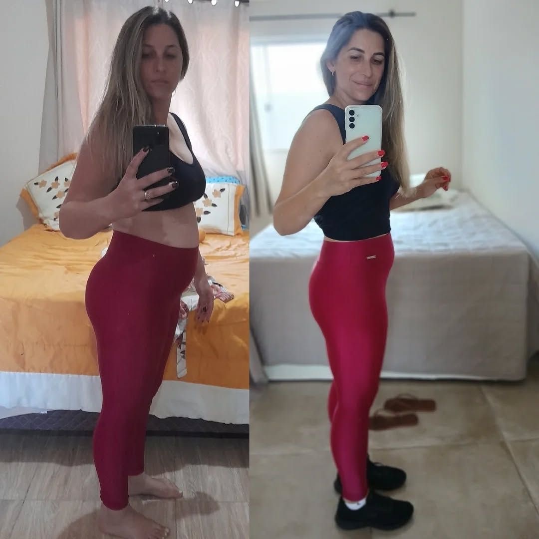 Transformação de Renata em 20 dias