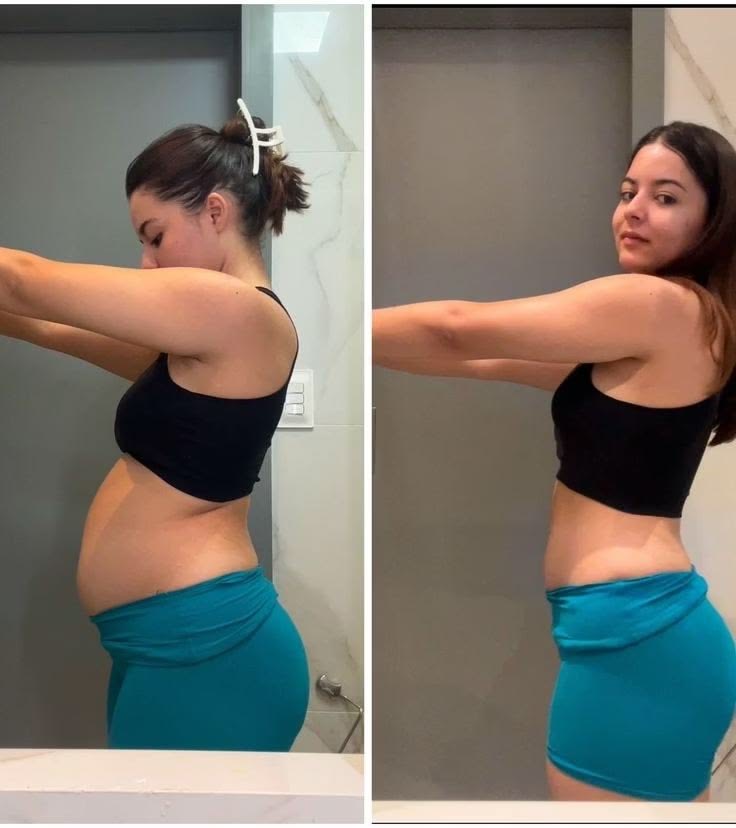 Transformação de Beatriz em 12 dias